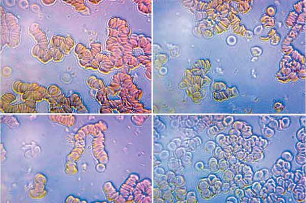 Способна ли мелодия на терапию?